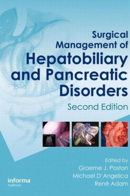 Surgical Management of Hepatobiliary and Pancreatic Disorders, Hardback Book