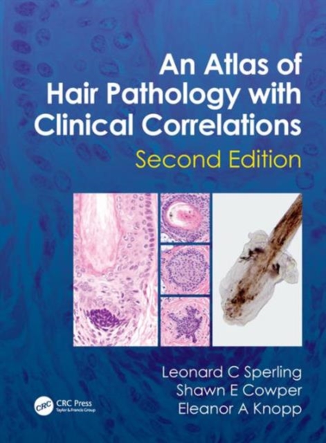 An Atlas of Hair Pathology with Clinical Correlations, Hardback Book