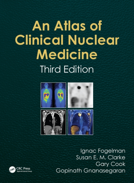 Atlas of Clinical Nuclear Medicine, PDF eBook