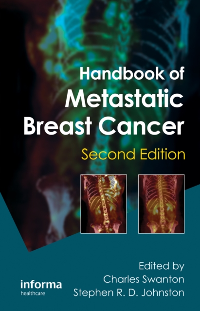 Handbook of Metastatic Breast Cancer, PDF eBook