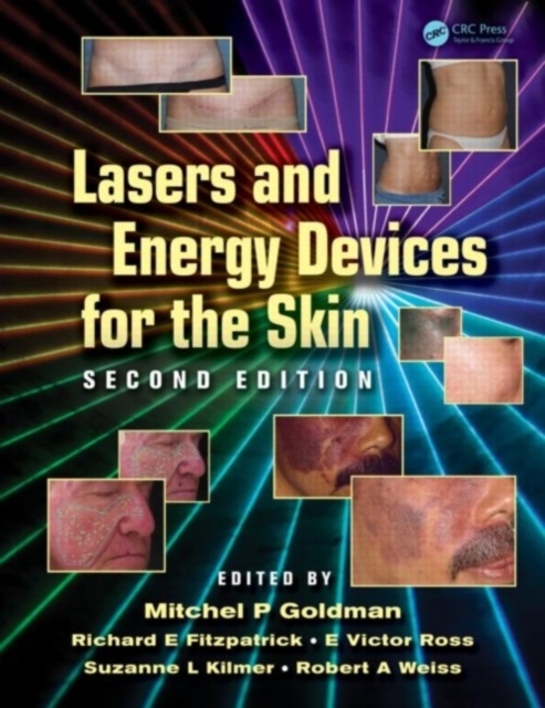 Lasers and Energy Devices for the Skin, PDF eBook