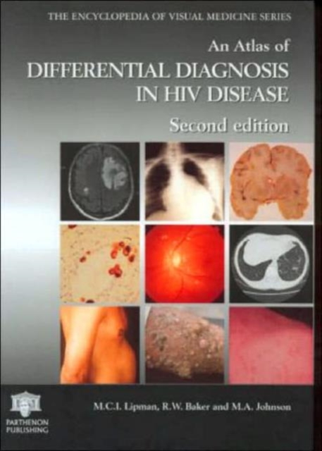 An Atlas of Differential Diagnosis in HIV Disease, Hardback Book