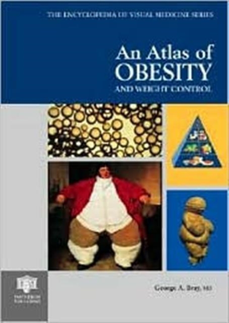 An Atlas of Obesity and Weight Control, Hardback Book