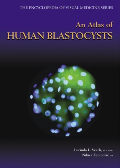 An Atlas of Human Blastocysts, Hardback Book