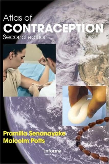 Atlas of Contraception, Hardback Book