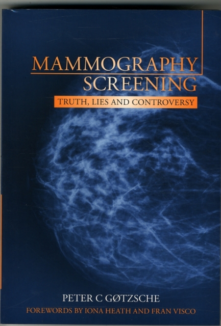 Mammography Screening : Truth, lies and controversy, Paperback / softback Book