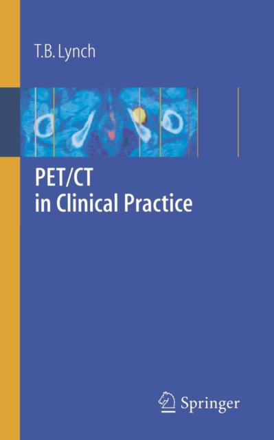 PET/CT in Clinical Practice, Paperback / softback Book