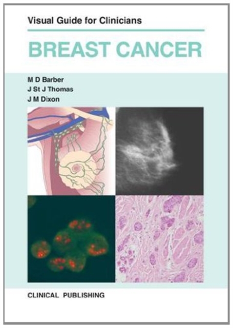 Breast Cancer : Visual Guide for Clinicians, Hardback Book