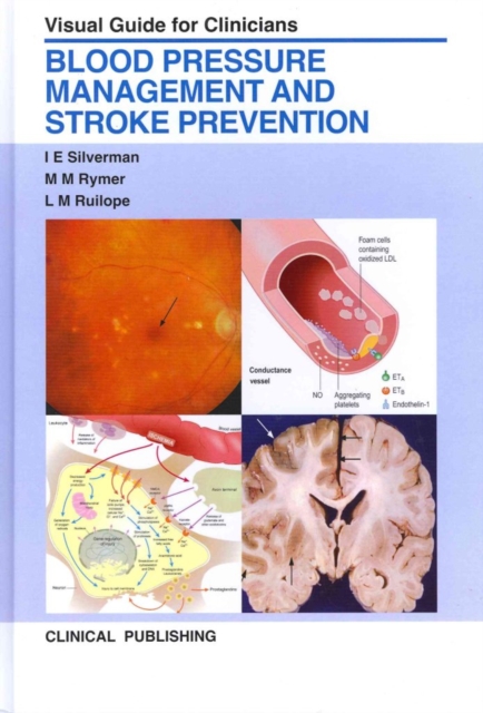 Blood Pressure Management and Stroke Prevention : Visual Guide for Clinicians, Hardback Book