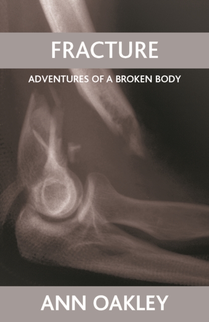 Fracture : Adventures of a broken body, PDF eBook