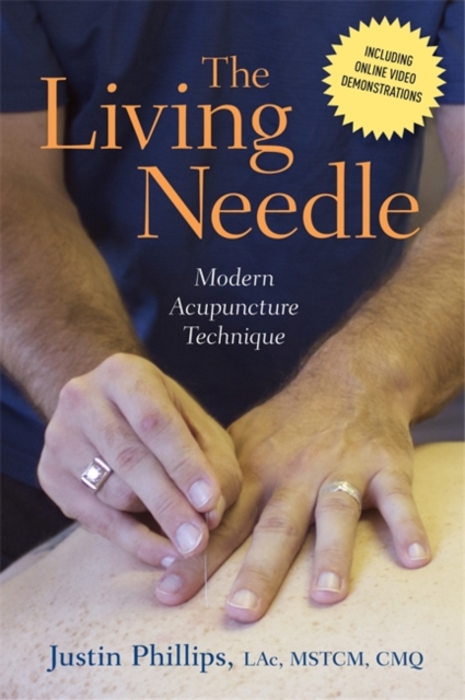 The Living Needle : Modern Acupuncture Technique, Hardback Book