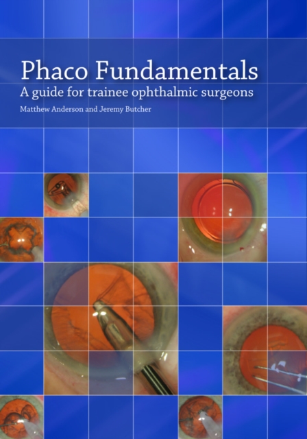 Phaco Fundamentals : A Guide for Trainee Ophthalmic Surgeons, Paperback / softback Book