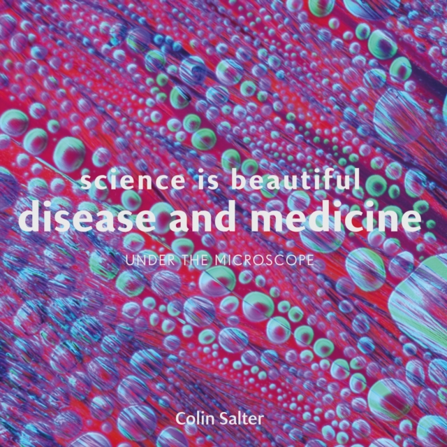 Science is Beautiful: Disease and Medicine : Under the Microscope, Hardback Book