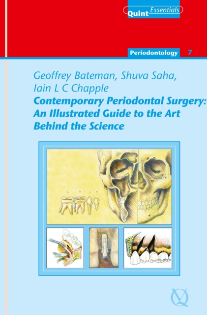Contemporary Periodontal Surgery : An Illustrated Guide to the Art behind the Science, EPUB eBook