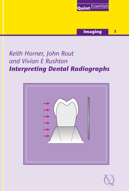Interpreting Dental Radiographs, EPUB eBook