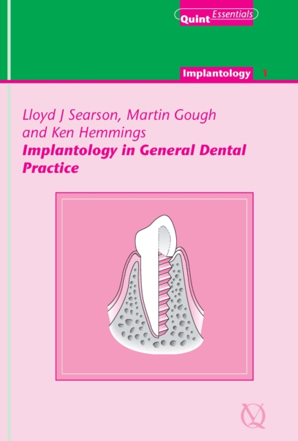 Implantology in General Dental Practice, EPUB eBook