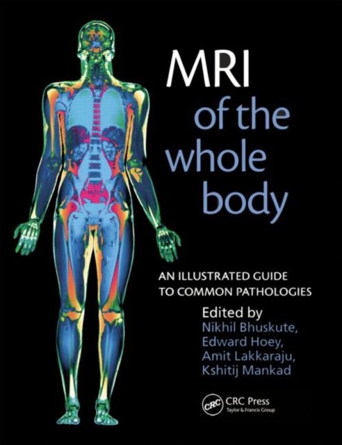 MRI of the Whole Body : An Illustrated Guide for Common Pathologies, Paperback / softback Book
