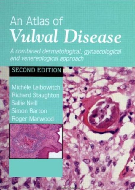An Atlas of Vulval Diseases : A Combined Dermatological, Gynaecological and Venereological Approach, Hardback Book