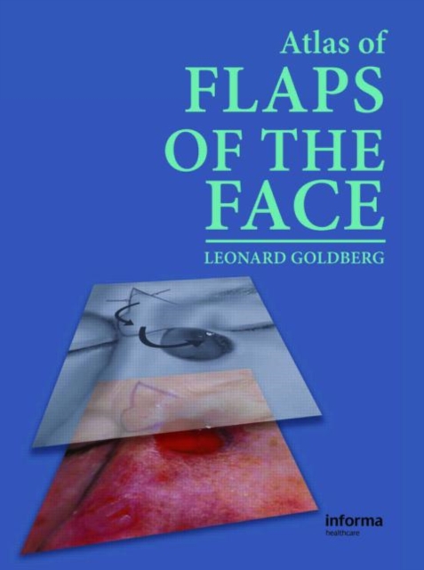 An Atlas of Flaps of the Face, Mixed media product Book