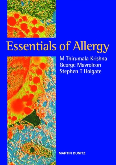 Essentials of Allergy, Paperback / softback Book