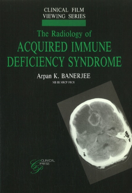 Radiology of Acquired Immune Deficiency Syndrome, Paperback / softback Book