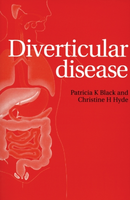 Diverticular Disease, Paperback / softback Book