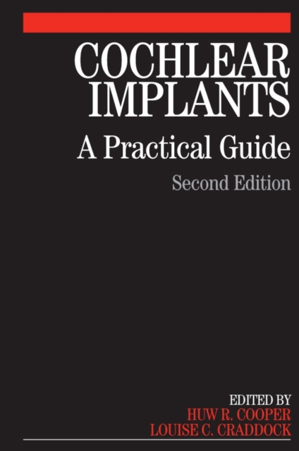 Cochlear Implants : A Practical Guide, Paperback / softback Book