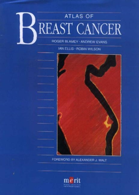 Atlas of Breast Cancer, Hardback Book
