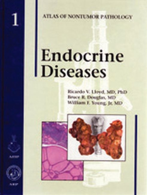 Endocrine Diseases, Hardback Book
