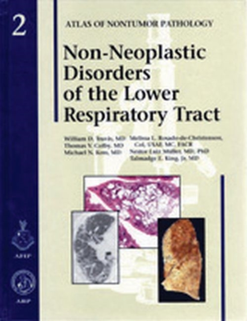 Non-Neoplastic Disorders of the Lower Respiratory Tract, Hardback Book
