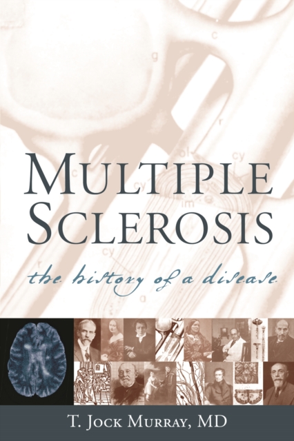 Multiple Sclerosis : The History of a Disease, Paperback / softback Book