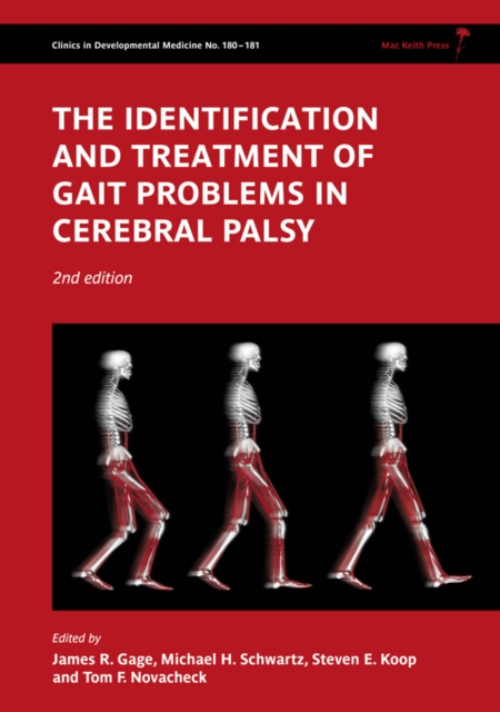 The Identification and Treatment of Gait Problems in Cerebral Palsy, Hardback Book