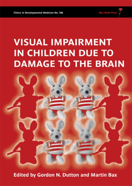 Visual Impairment in Children due to Damage to the Brain, Hardback Book
