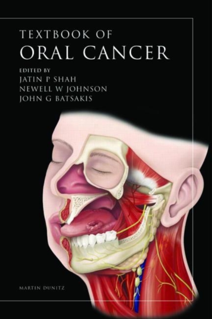 Oral Cancer, Hardback Book
