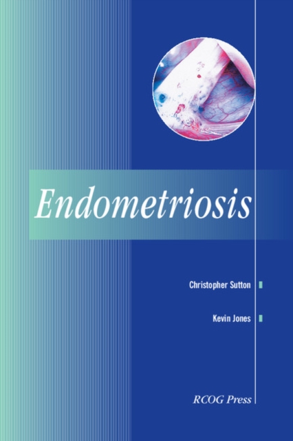 Endometriosis, Paperback / softback Book