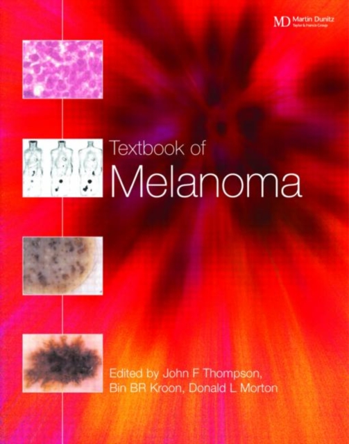 Textbook of Melanoma : Pathology, Diagnosis and Management, Hardback Book
