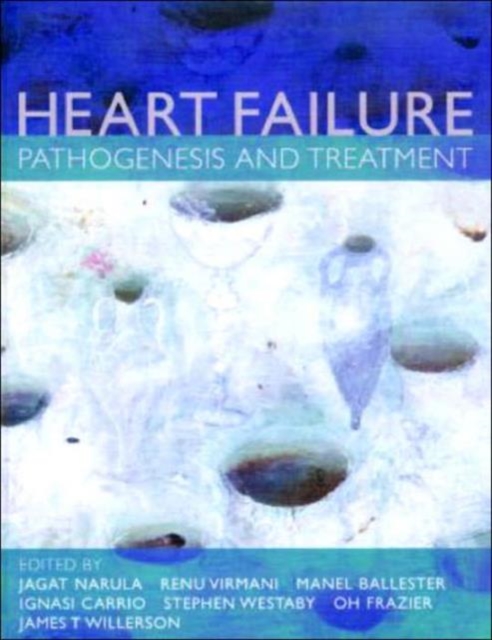 Management of Heart Failure, Hardback Book