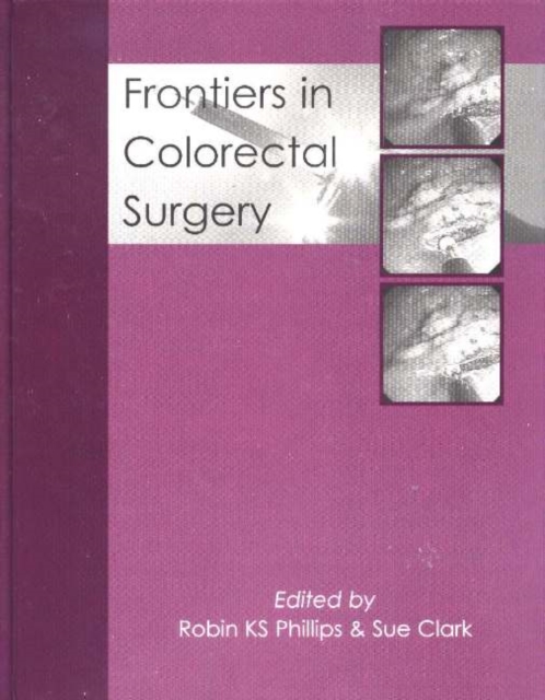 Frontiers in Colorectal Surgery, Hardback Book
