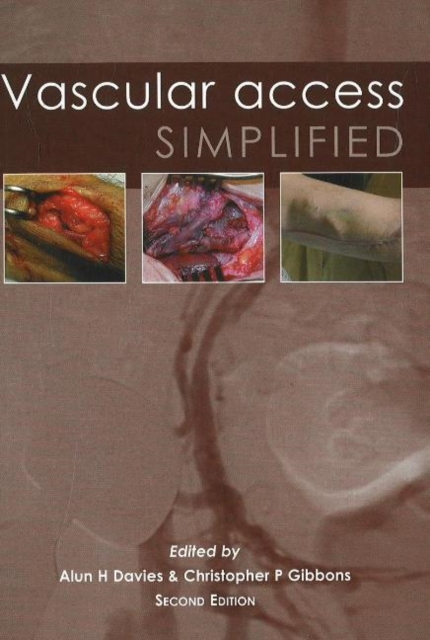 Vascular Access Simplified; second edition, Paperback / softback Book