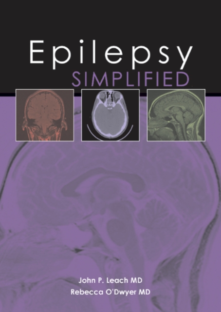 Epilepsy Simplified, Paperback / softback Book