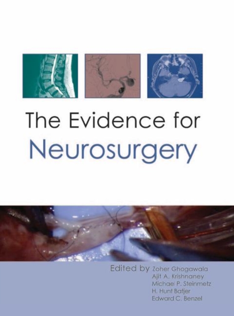 The Evidence for Neurosurgery, Hardback Book
