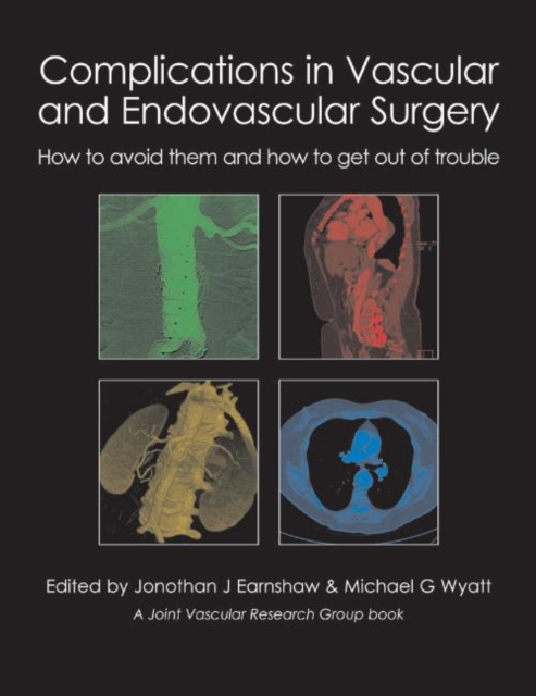 Complications in Vascular and Endovascular Surgery : How to avoid them and how to get out of trouble, Hardback Book