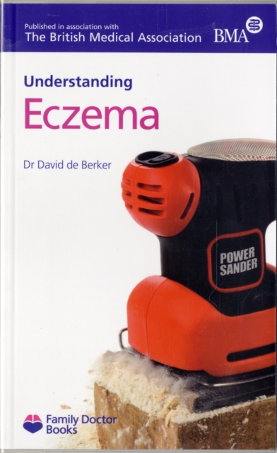Understanding Eczema, Paperback Book