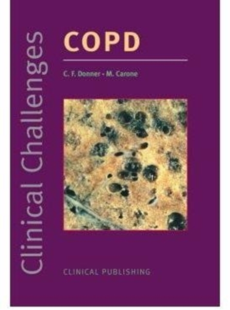 COPD, Hardback Book
