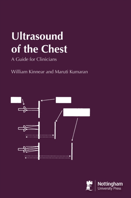 Ultrasound of the Chest : A Guide for Clinicians, Paperback / softback Book