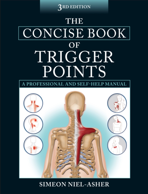 The Concise Book of Trigger Points, Paperback / softback Book