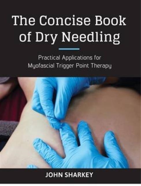 The Concise Book of Dry Needling : A Practitioner's Guide to Myofascial Trigger Point Applications, Paperback / softback Book