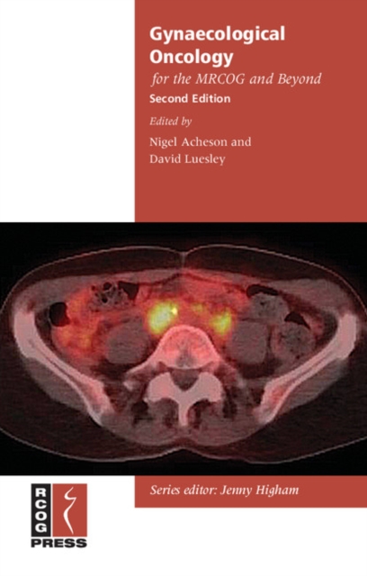 Gynaecological Oncology for the MRCOG and Beyond, Paperback / softback Book