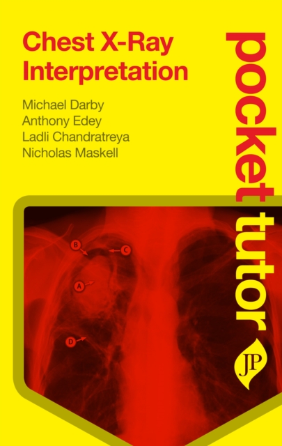 Pocket Tutor Chest X-Ray Interpretation, Paperback / softback Book