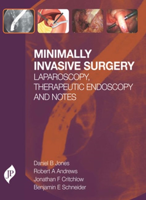 Minimally Invasive Surgery : Laparoscopy, Therapeutic Endoscopy and NOTES, Hardback Book